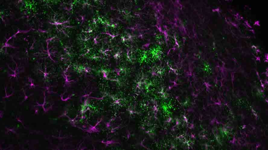 microscope image of brain cells stained with green (mitochondria) and purple (olfactory bulb)